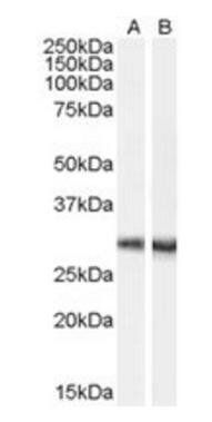 Dcdc2a Antibody