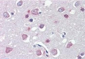 FEZ1/Zygin 1 Antibody