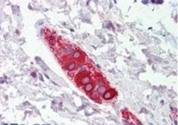 FEZ1/Zygin 1 Antibody