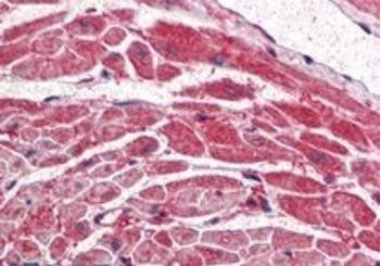 PIK3CA/P110alpha Antibody