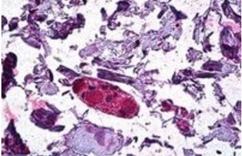 DGAT1 Antibody