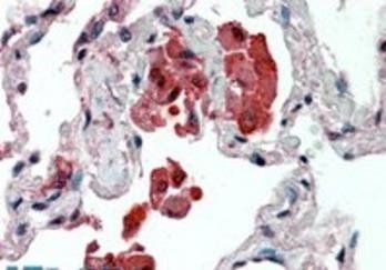 Insulysin/Insulinase Antibody