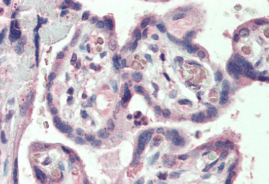 KCC1/SLC12A4 Antibody