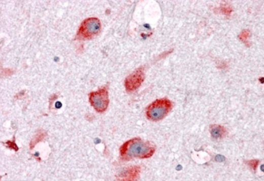 Ribosomal protein L22 Antibody