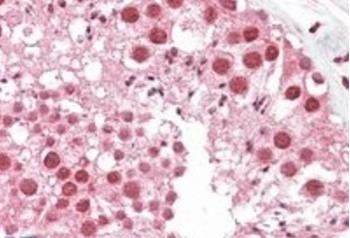 MSH5 Antibody