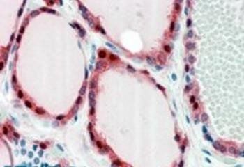 Frizzled 2 Antibody