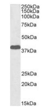 Laforin (isoform a), Biotinylated Antibody