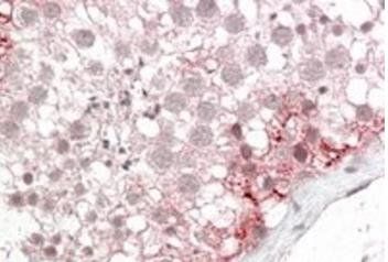 ABCD3 Antibody
