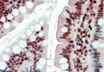 EWS/EWSR1 Antibody
