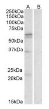 LAT1/SLC7A5 Antibody