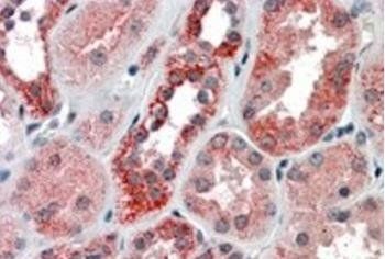 IREB2/IRP2 Antibody
