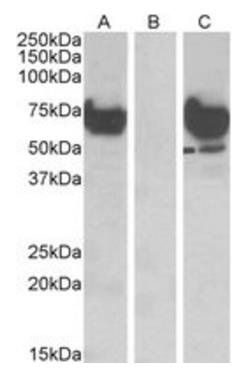 EPM2AIP1 Antibody
