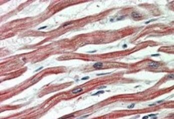 EPM2AIP1 Antibody