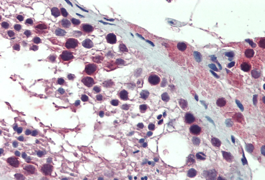 PREX1 Antibody
