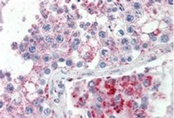 SPAG16 Antibody
