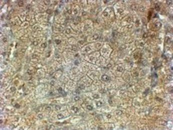 PON2 Antibody