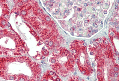 CHCHD3 (aa151-164) Antibody