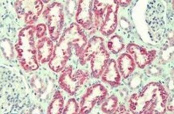 ANTXR2/CMG2 Antibody