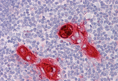 CXCR6 Antibody