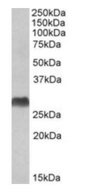 Goat anti-HLA-DQA2 & HLA-DQA1 Antibody