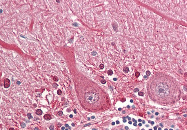 Goat anti-SEPT4 (aa425-435) Antibody