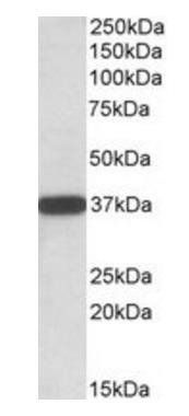 Goat anti-CYB5R3 / Dia 1 Antibody