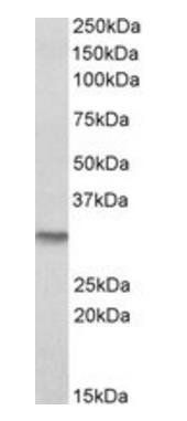 NQO1 (isoform a) Antibody