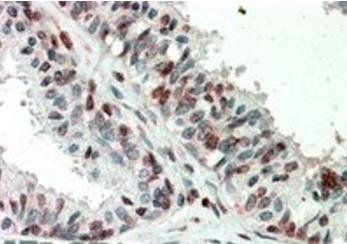 ZIC3 (aa178-189) Antibody