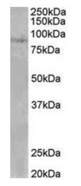 SETDB2 Antibody