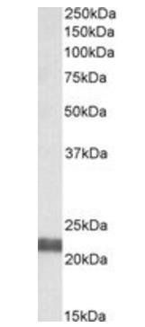 NEDD8 conjugating enzyme (N Terminus) Antibody