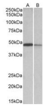 TXNDC5 (aa281-295) Antibody