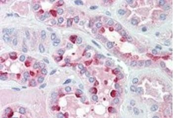 IDH3G (aa337-350) Antibody