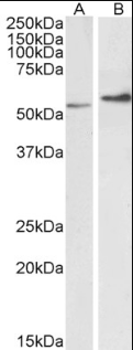 Vimentin Antibody