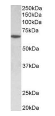 SOX11 (aa309-323) Antibody