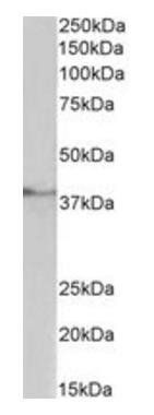 TBP /Transcription factor IID (aa39-50) Antibody