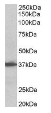 AIMP1/SCYE1 (aa137-149) Antibody