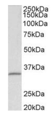 fibrillarin/FBL (aa99-110) Antibody