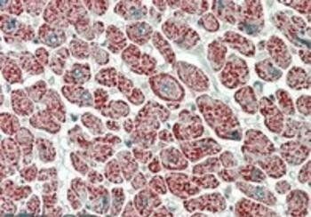NDUFA7 Antibody