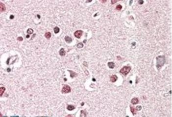 Endophilin-A1/SH3GL2 Antibody