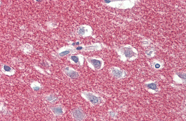 AP2A1 (aa706-727) Antibody