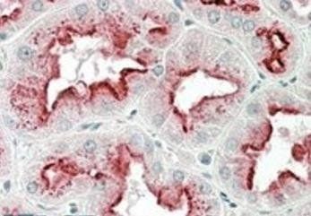 Goat anti-APOD Antibody