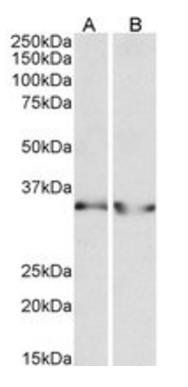 Goat anti-LDHB (aa15-25) Antibody
