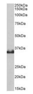 LDHB Antibody