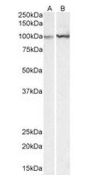 ACTN1 (aa596-609) Antibody