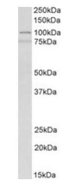 ACTN1 (aa596-609) Antibody