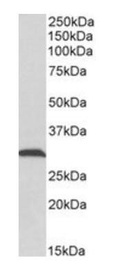 ATP5C1 (aa27-40) Antibody