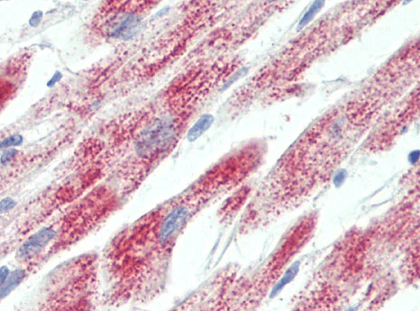 ATP5C1 Antibody