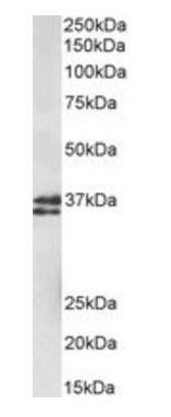 MSI2/musashi-2 Antibody
