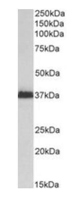 MSI2/musashi-2 Antibody