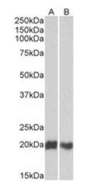 Goat anti-CD3D (isoform A) Antibody